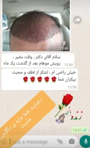 رضایت مراجع گرگانی از کاشت مو