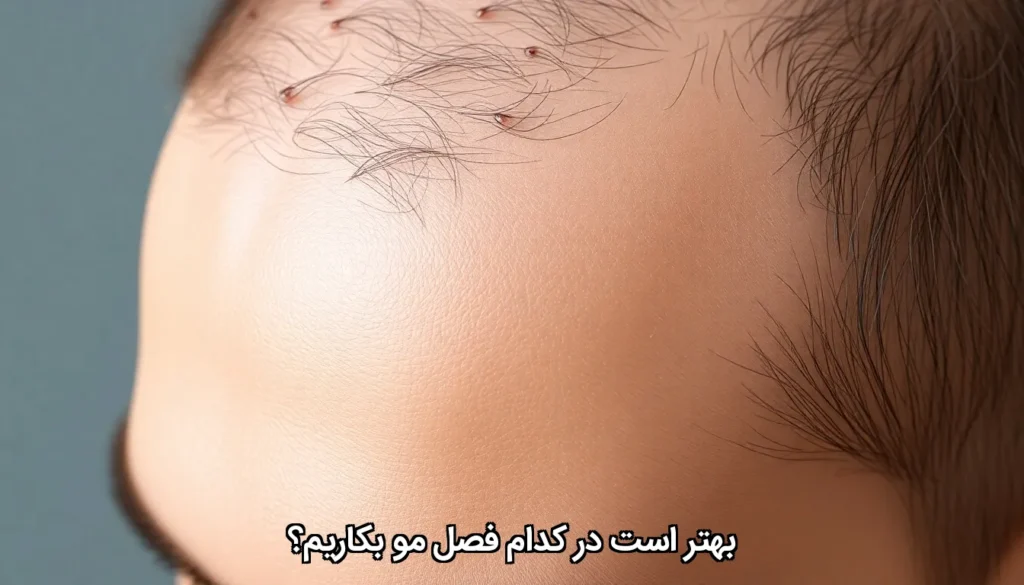 کدام فصل مو بکاریم؟